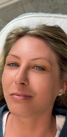 Brows before nano combo brows